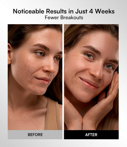 Red Light Therapy Face Mask